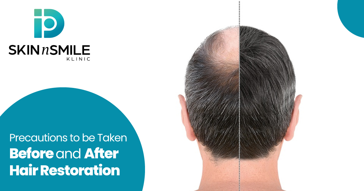 Hair Restoration Hair Restoration