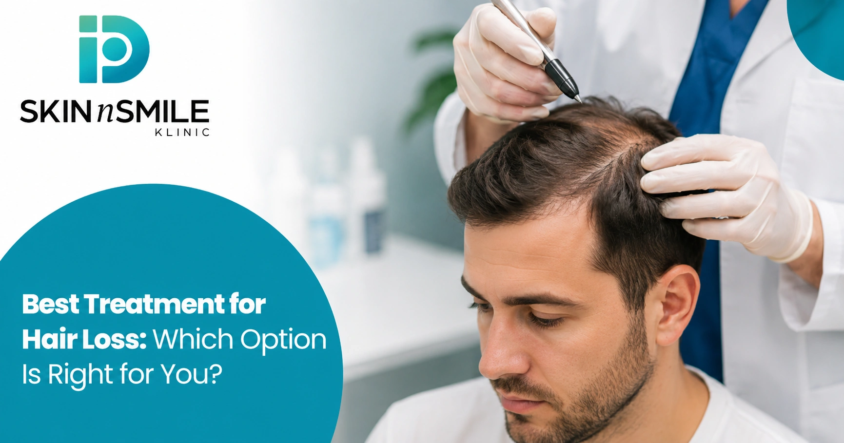 Best treatment for hair loss