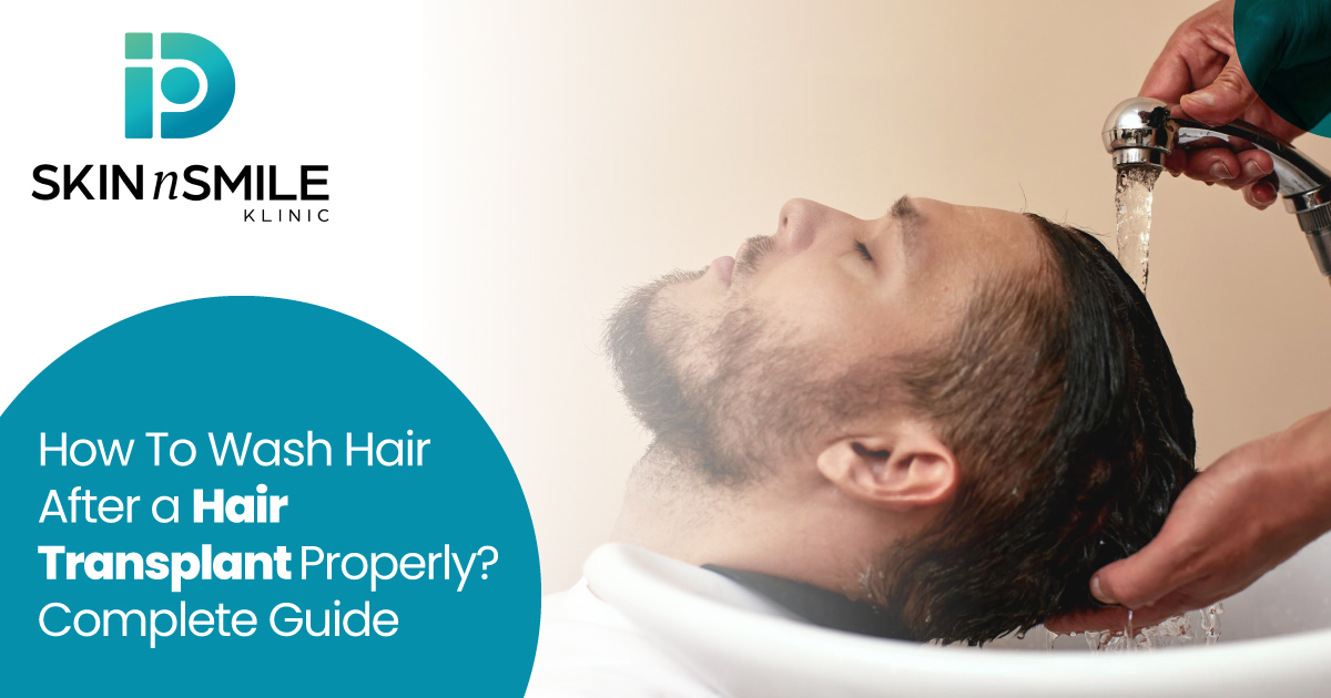 How To Wash Hair After a Hair Transplant Properly