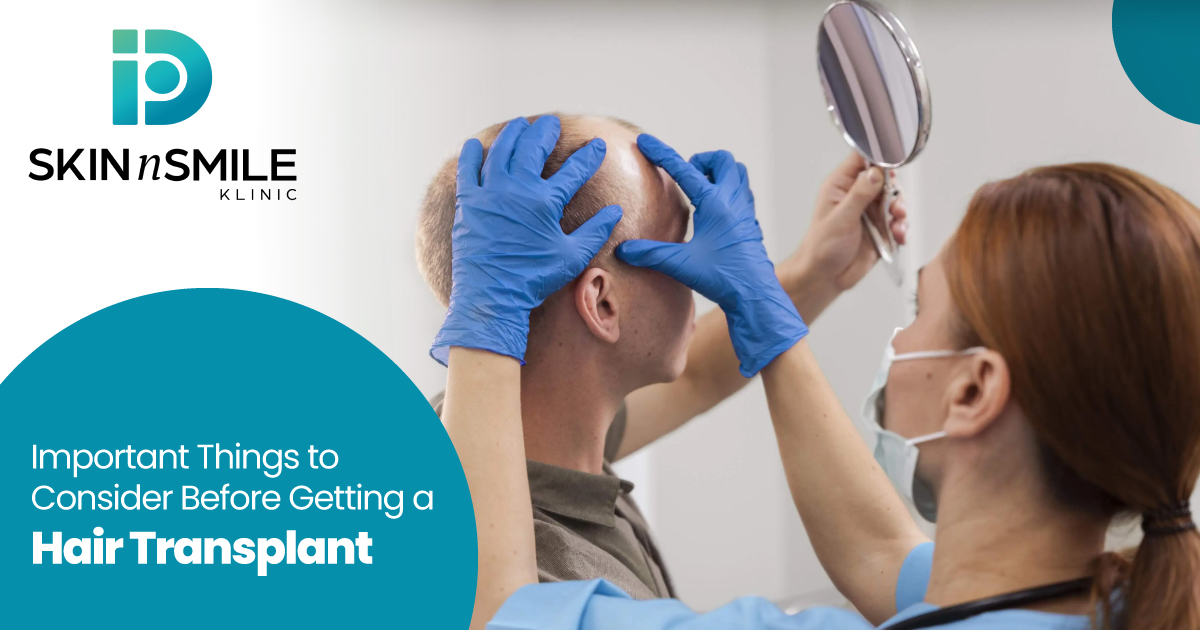 Advantages of Hair Transplant Advantages of Hair Transplant