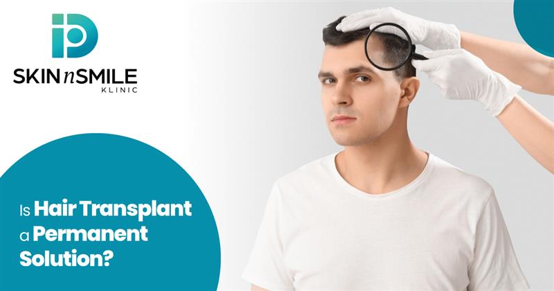 Advantages of Hair Transplant Advantages of Hair Transplant