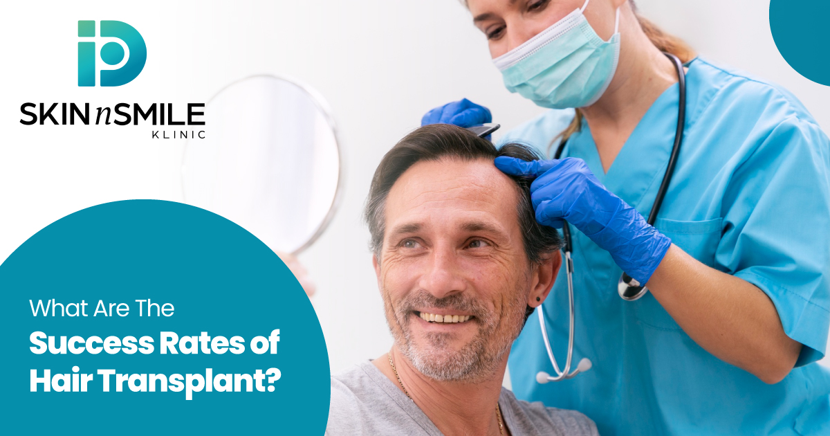 Advantages of Hair Transplant Advantages of Hair Transplant