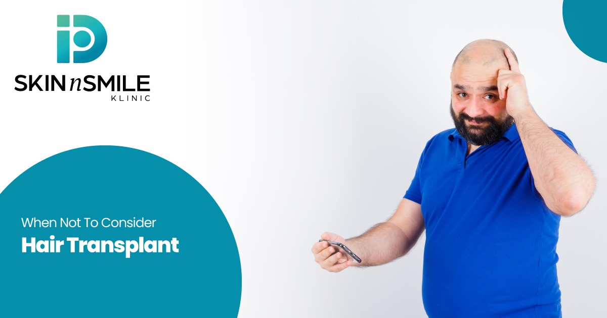 Consider a Hair Transplant?