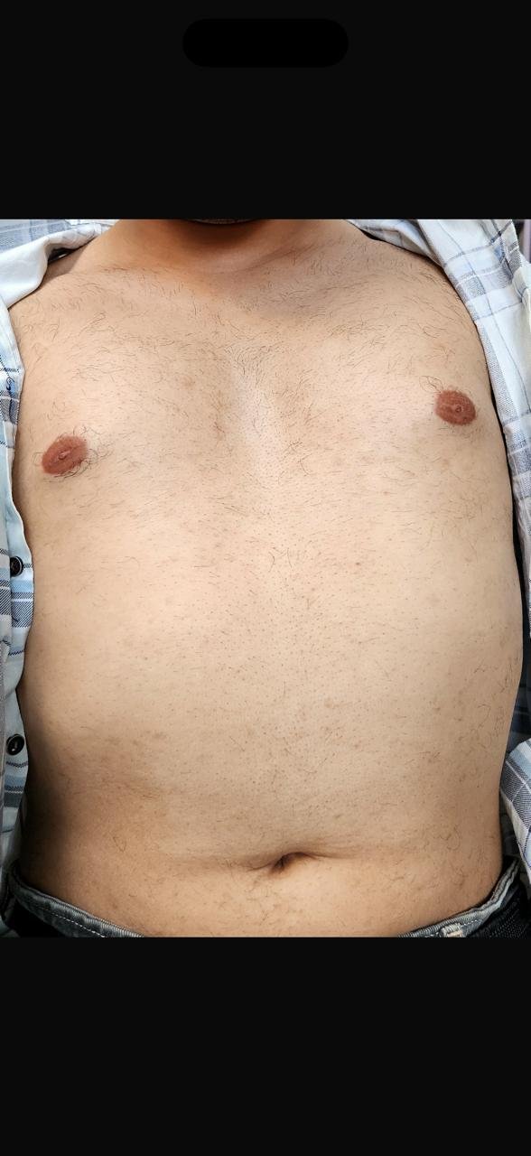 After